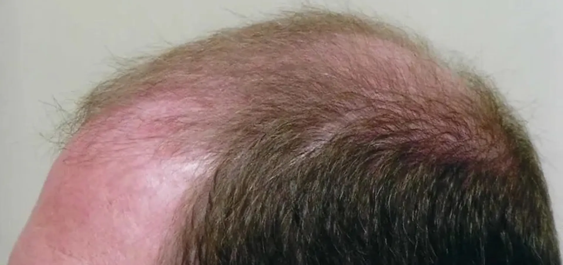 Before treatment 2