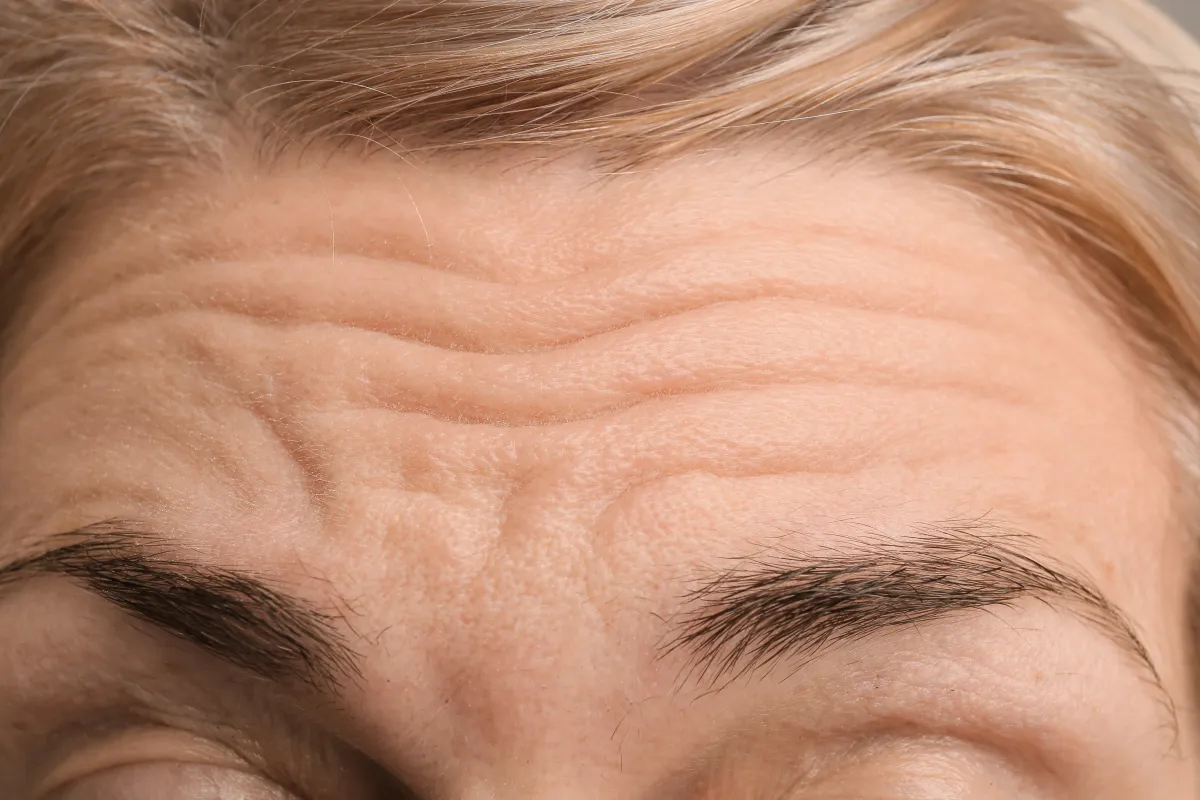 Before treatment 3