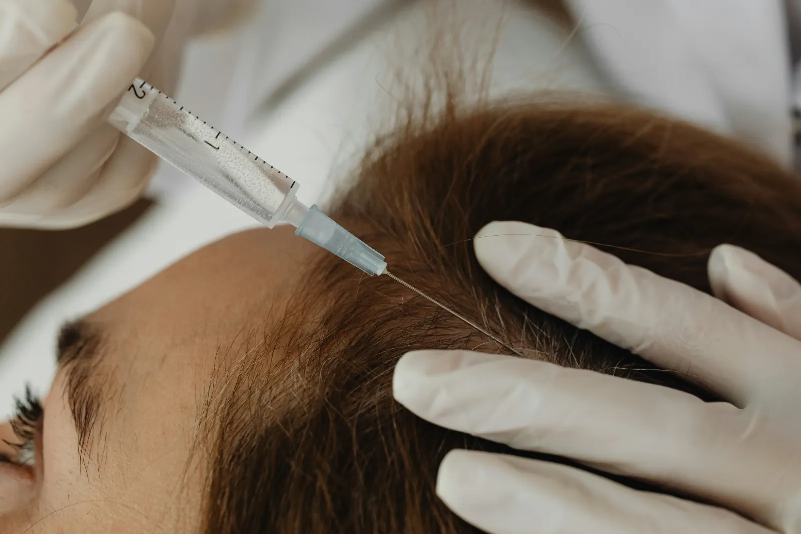 Hair Regeneration