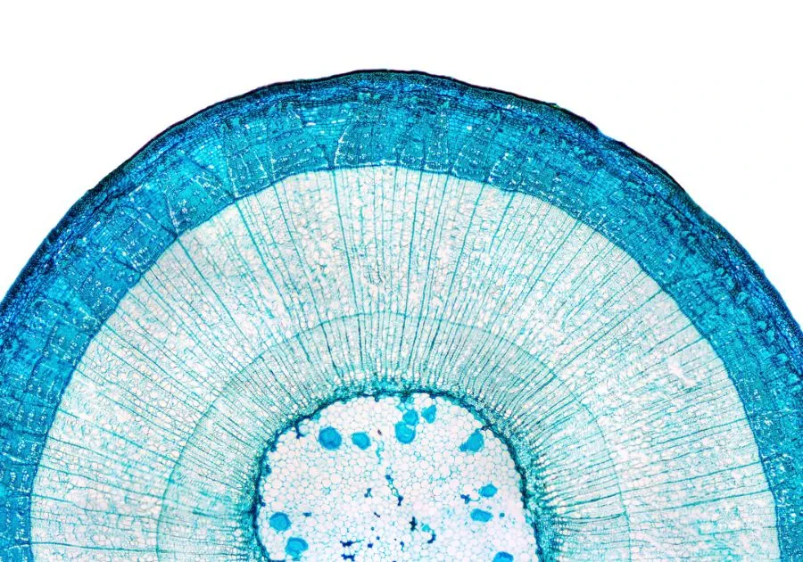 Stem Cell Treatment
